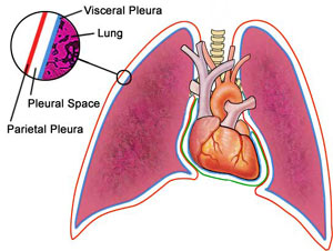 Pleura